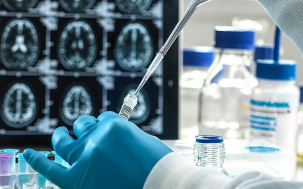 b9d242731ce1967f2c8af3cf9a4ff44b_1677206